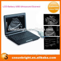 Full digital system/china portable ultrasound Device price / color USG